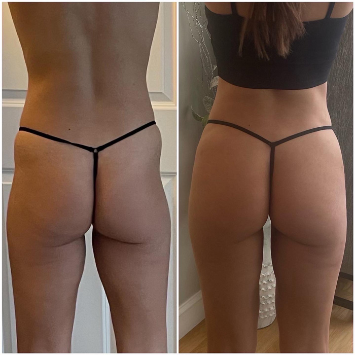 Transformation 7